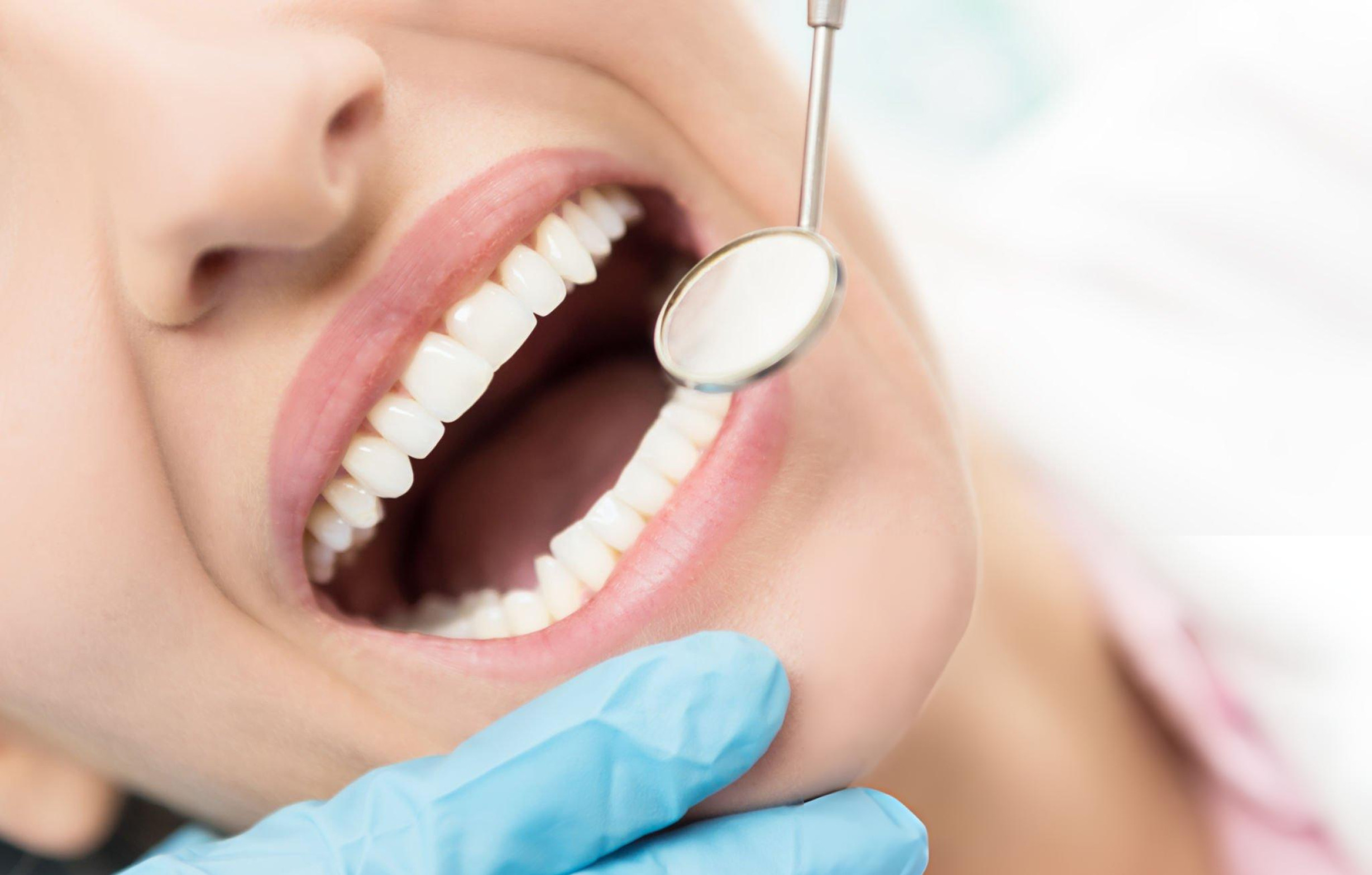 Examen dentaire clinique avec miroir buccal